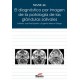 El Diagnóstico por Imagen de la Patología de las Glándulas Salivales