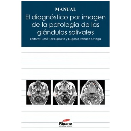El Diagnóstico por Imagen de la Patología de las Glándulas Salivales