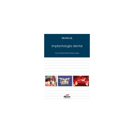 Implantología dental