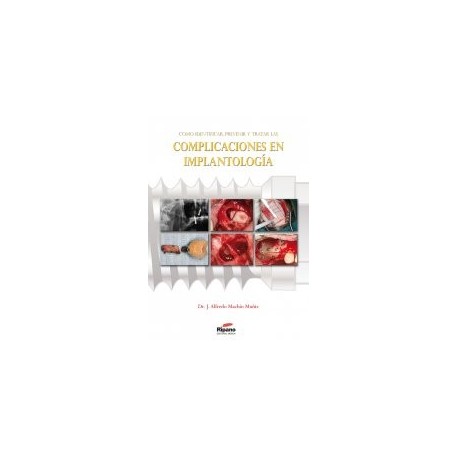 Cómo Identificar, Prevenir y Tratar las Complicaciones en Implantología