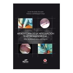 Artroscopía de la Articulación Temporomandibular