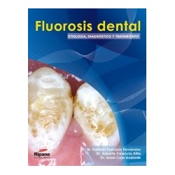 Fluorosis Dental. Etiología, Diagnóstico y Tratamiento