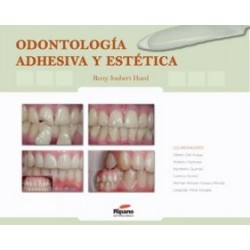 Odontología Adhesiva y Estética