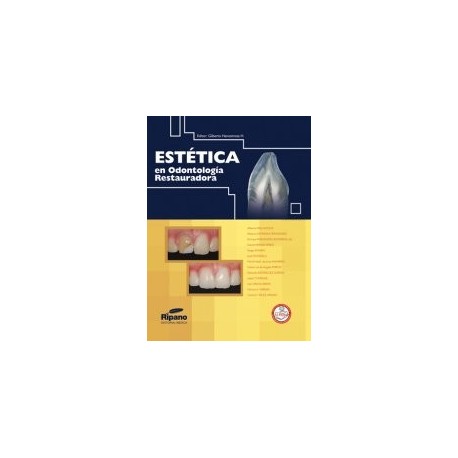 Estética en Odontología Restauradora