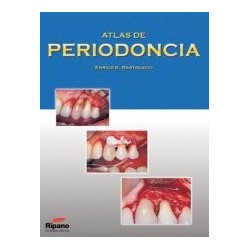 Atlas de Periodoncia