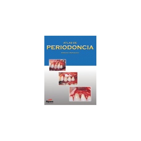 Atlas de Periodoncia