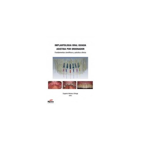 Implantología Oral Guiada Asistida por Ordenador