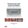 Implantología Oral Guiada Asistida por Ordenador