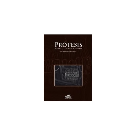 Prótesis. Bases y fundamentos
