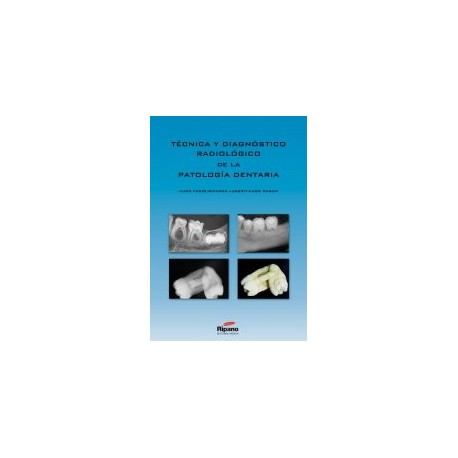 Técnica y Diagnóstico Radiológico de la Patología Dentaria