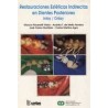 RESTAURACIONES ESTETICAS INDIRECTAS EN DIENTES POSTERIORES