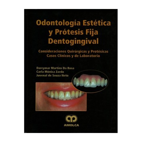 ODONTOLOGIA ESTETICA Y PROTESIS FIJA DENTOGINGIVAL