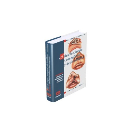 Atlas de Cirugía Craneofacial y de Hendiduras Cirugía de Hendiduras Labial y Palatina – Volumen II