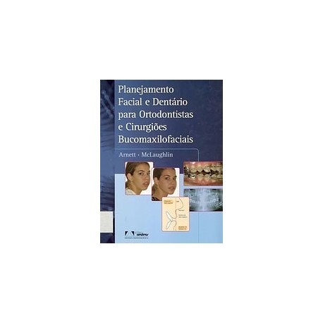 PLANEJAMENTO FACIAL E DENTARIO PARA ORTODONTISTAS E CIRURGIOES BUCOMAXILOFACIAIS