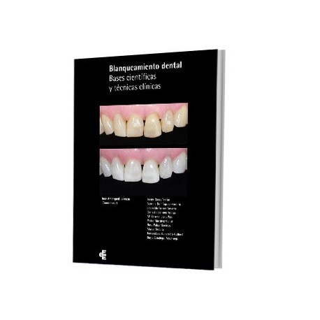 BLANQUEAMIENTO DENTAL BASES CIENTIFICAS Y TECNICAS CLINICAS