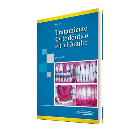 Tratamiento Ortodóntico en el Adulto