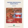 Prótesis periodontal telescopica