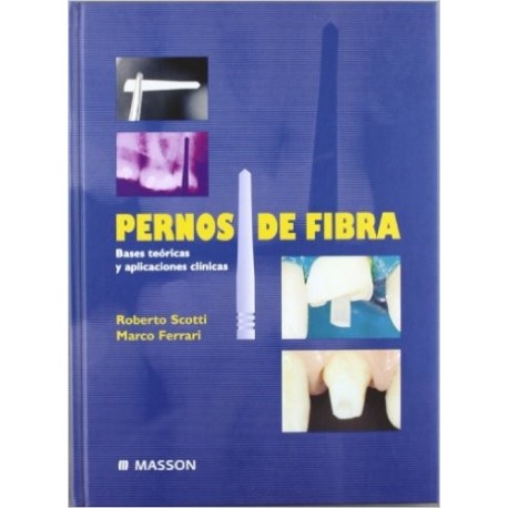 PERNOS DE FIBRA