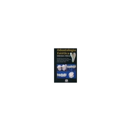 ODONTOLOGIA ESTETICA. SOLUCIONES CLINICAS