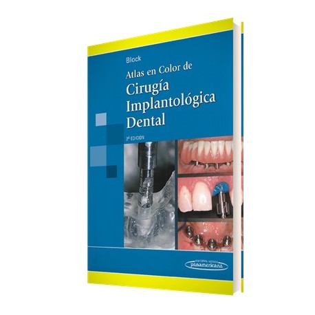 Atlas en Color de Cirugía Implantológica Dental