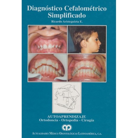 Diagnóstico Cefalométrico Simplificado