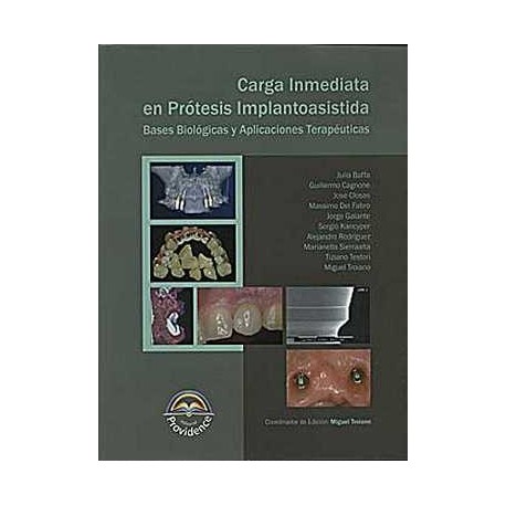 Carga inmediata en protesis implantoasistida