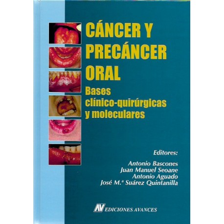 Cáncer y Precáncer Oral