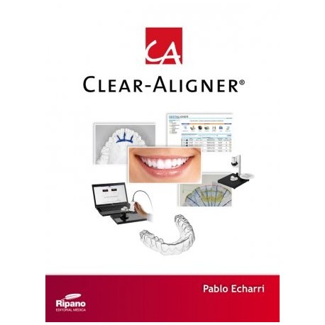 Clear Aligner (Deutsch)