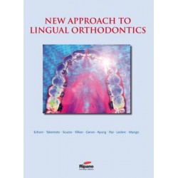 New Approach to Lingual Orthodontics