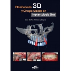 Planificación 3D y Cirugía Guiada en Implantología Oral