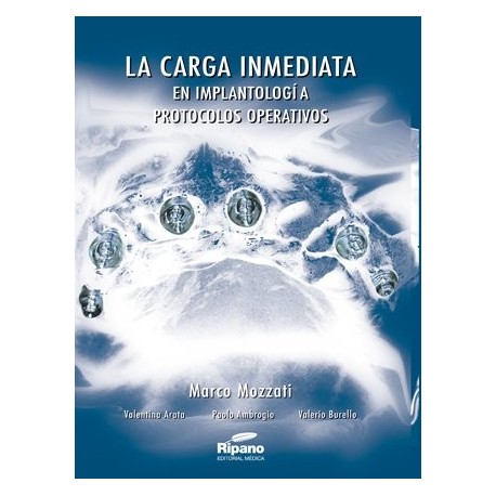 La Carga Inmediata en Implantología. Protocolos Operativos