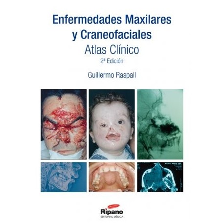Enfermedades Maxilares y Craneofaciales. Atlas Clínico